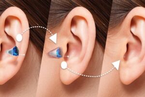 Discover the Sensational Success of Affordable German Hearing Aids in India! 15 hearing aids