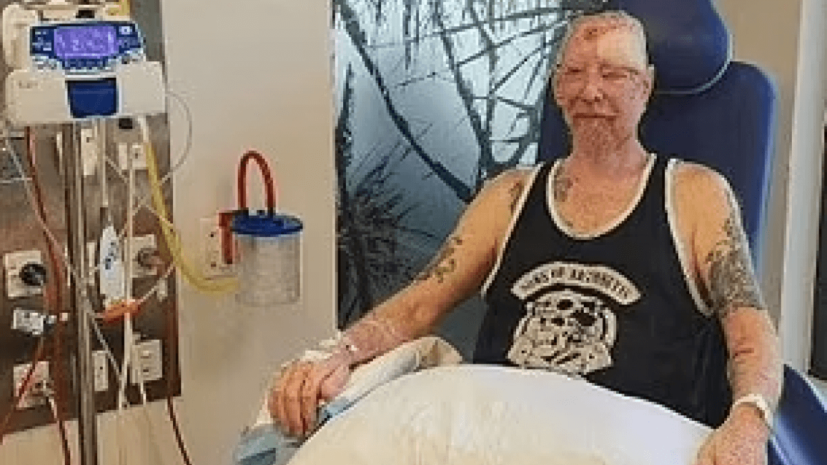 Man's 200 Skin Cancer Removals Serve as a Warning to Wear Sunscreen and Hats 15 Man's 200 Skin Cancer Removals Serve as a Warning to Wear Sunscreen and Hats