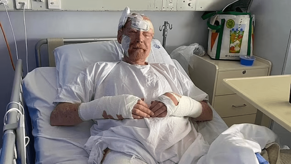 Man's 200 Skin Cancer Removals Serve as a Warning to Wear Sunscreen and Hats 3 Man's 200 Skin Cancer Removals Serve as a Warning to Wear Sunscreen and Hats
