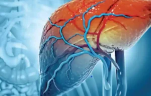 Understanding Hepatitis B and C in India : Shedding Light on the Silent Epidemic 28 Hepatitis B and C